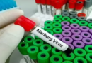 WHO convenes ‘urgent’ meeting over outbreak of Marburg virus